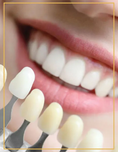 Porcelain crown shade guide next to natural teeth